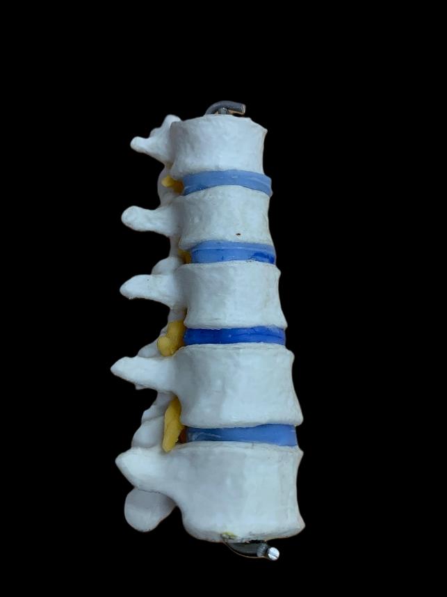 Manekin Vertebra HNP